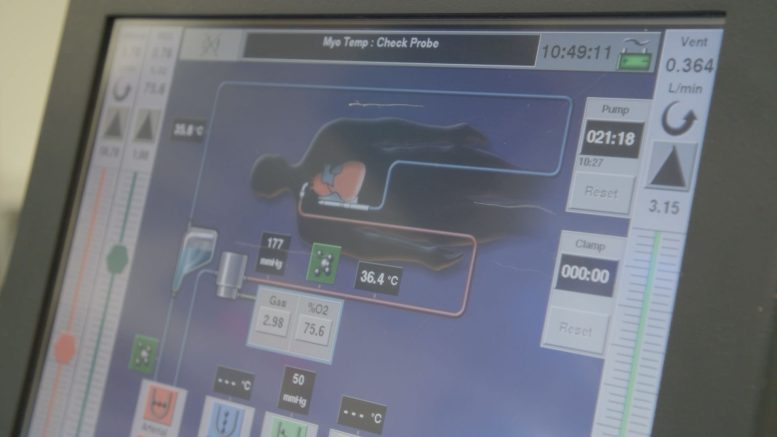 A Monitoring Screen That Tracks Blood Flow, Oxygen Levels, and Temperature