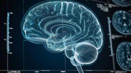 AI Analysis Brain Scan Art Concept