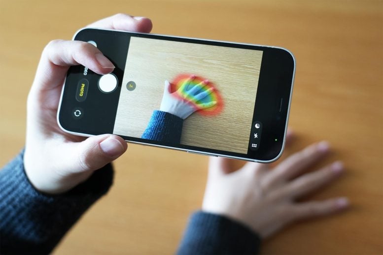 AI Hand Image Diagnose Acromegaly