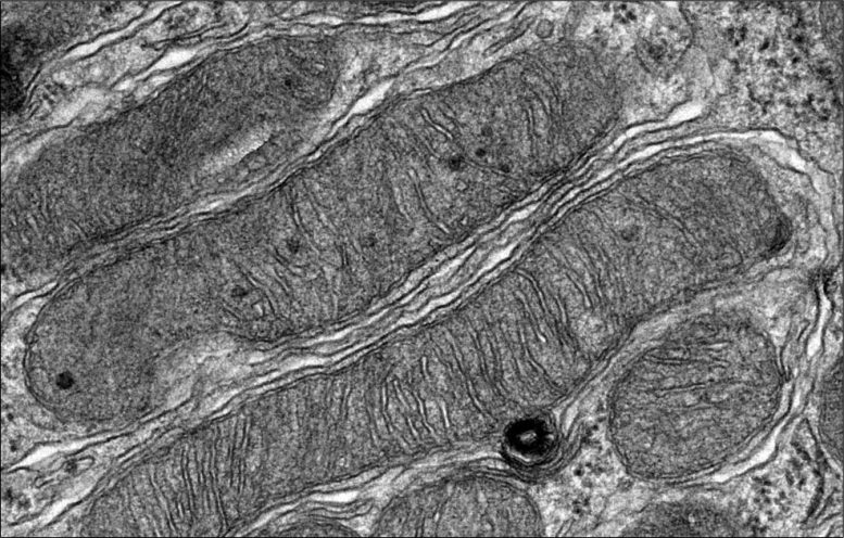 AKI Drug Rescue Mitochondria
