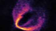 ALMA Discovers Trio of Infant Planets around Newborn Star