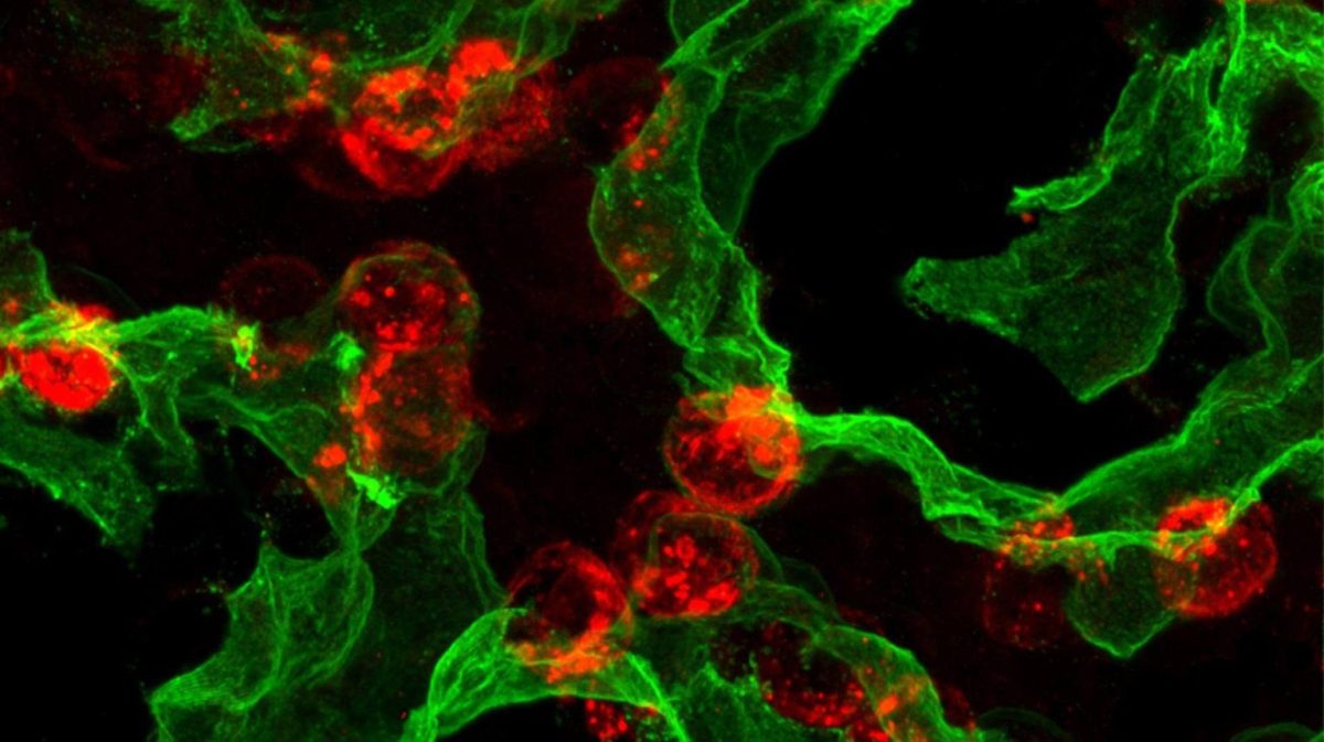 At2 Cells A Breakthrough Discovery Could Help Lungs Repair Themselves