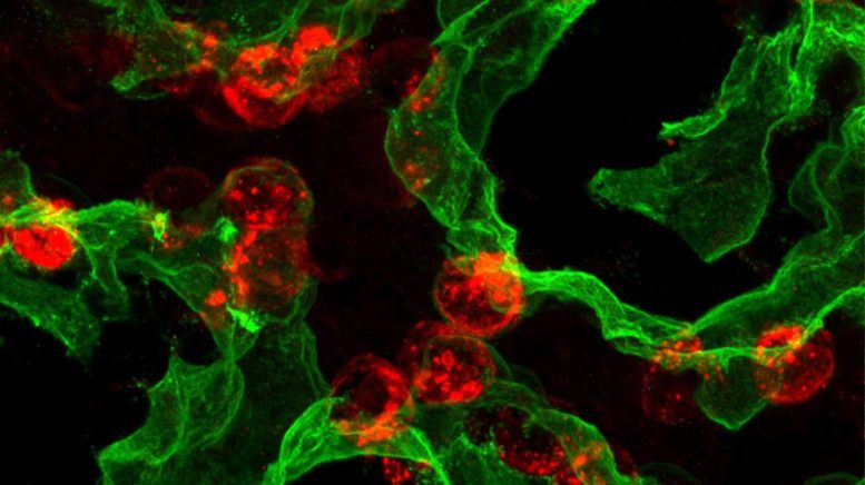 AT2 and AT1 Cells Lung Repair
