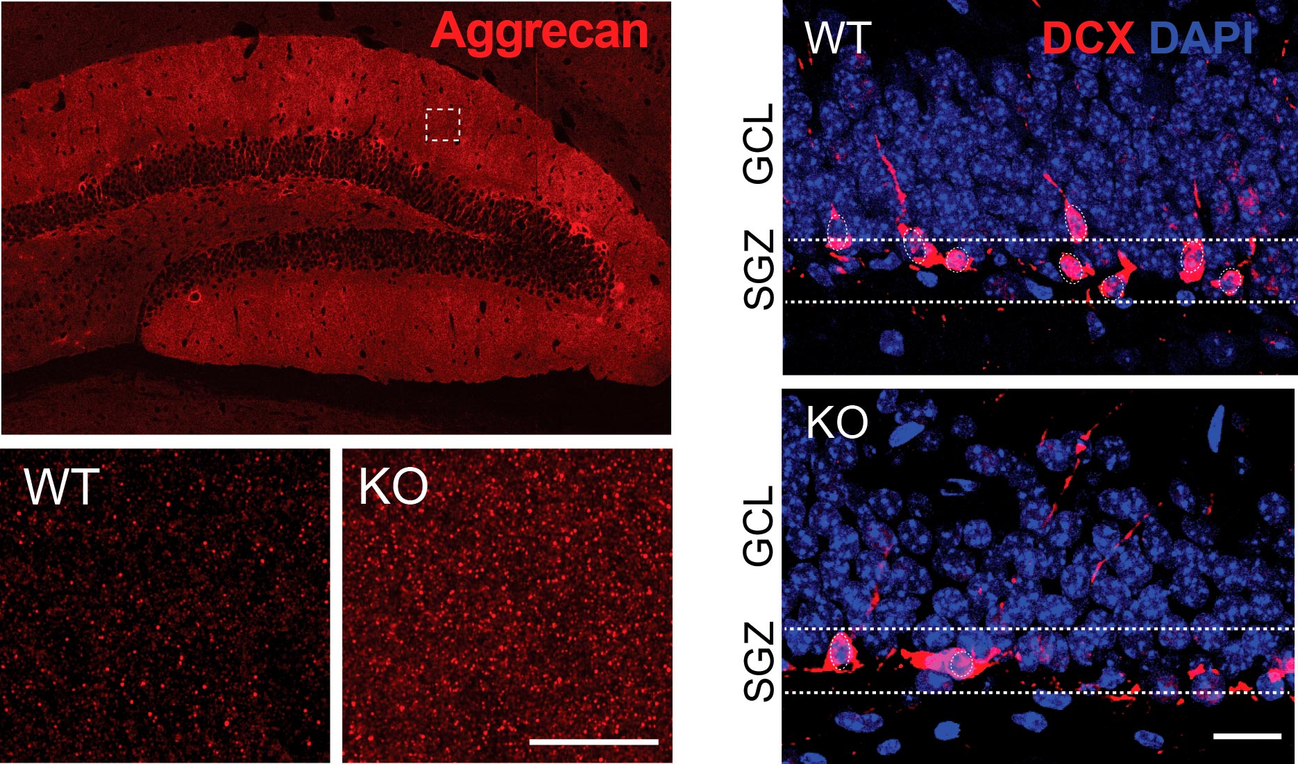 this-protein-could-be-the-key-to-turning-back-your-brain-s-aging-clock