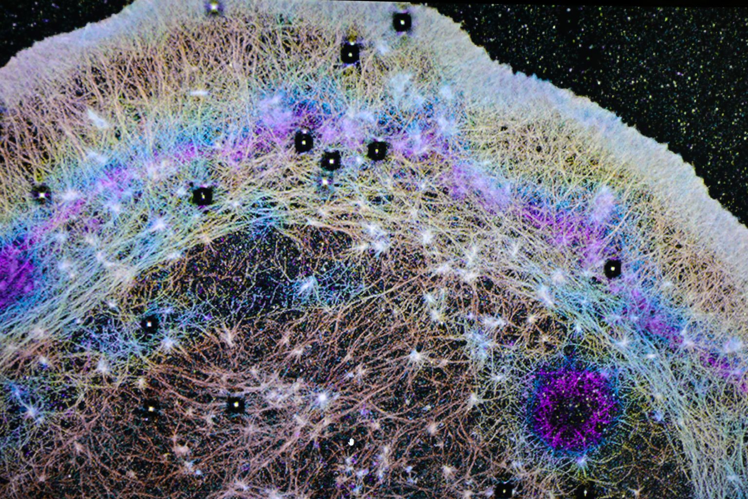 Inside Cell Particles Hidden “Trade Winds” Inside Cells Could Explain Cancer Spread