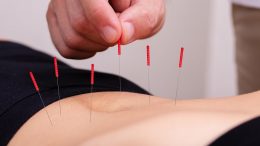 Acupuncture Treatment Belly