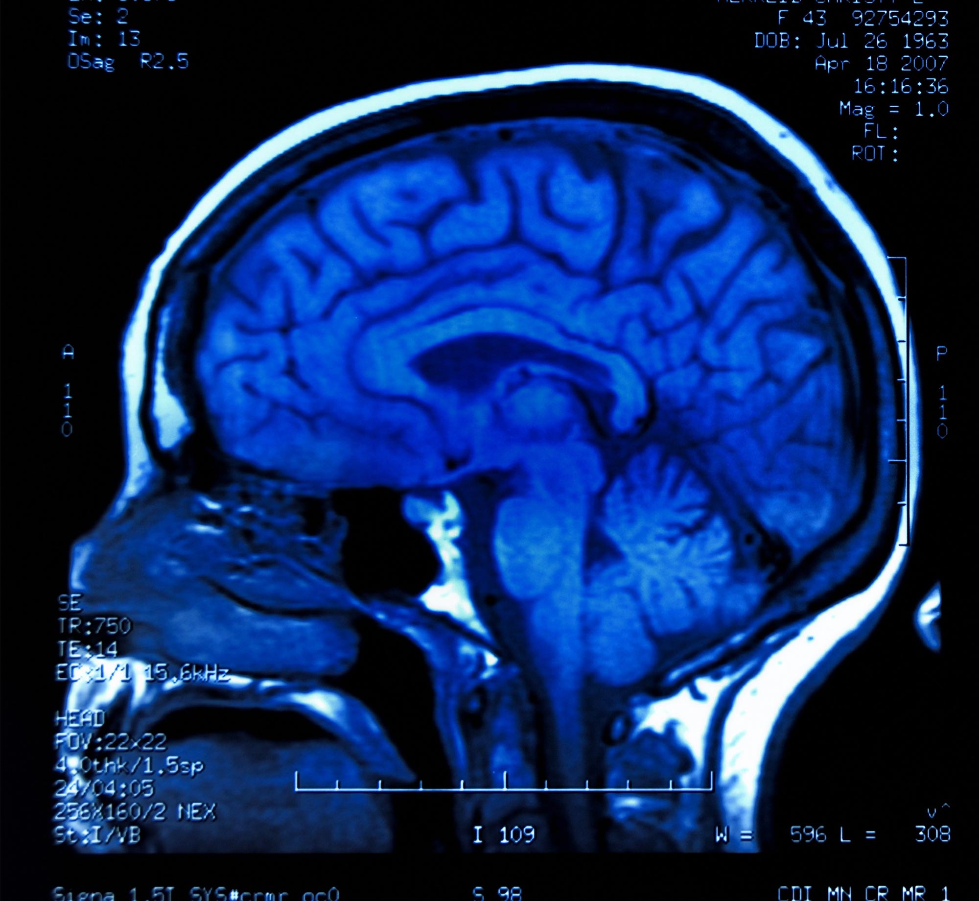 Adult Brain fMRI