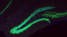 Adult Neurogenesis Mouse Brain