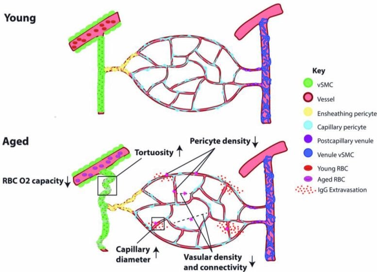 Gráfico de efectos de los vasos sanguíneos del cerebro envejecido