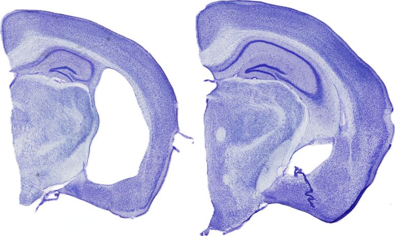 Alzheimer’s Brain Damage in Mice
