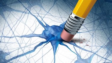 Alzheimers Dementia Brain Disease Concept