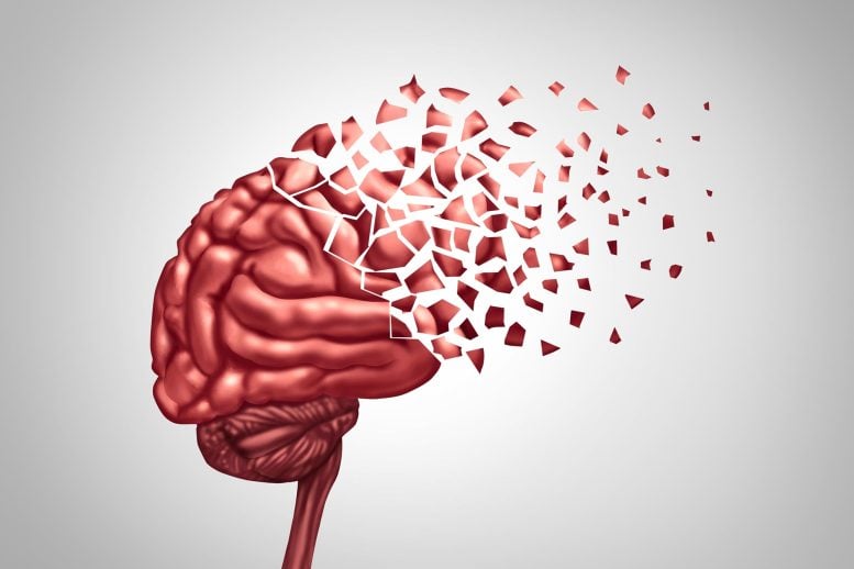 Alzheimers Dementia Brain Disease Memory Loss