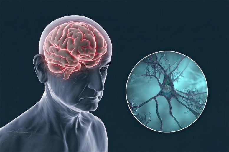 Scientists Call for a Complete Rethink of Alzheimer’s Treatment