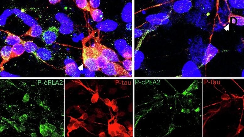 Alzheimer’s Molecules Screening