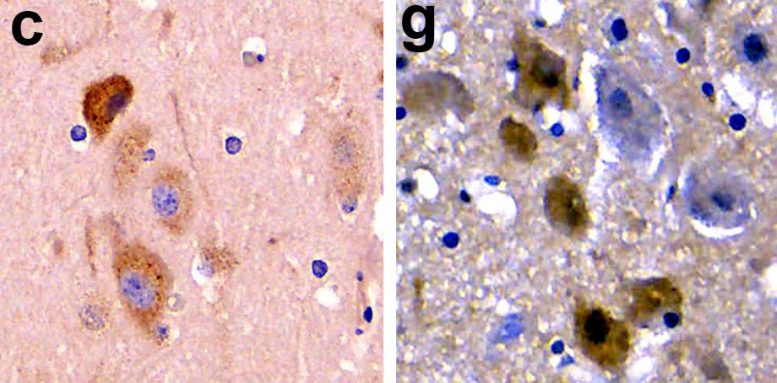 Alzheimer&rsquo;s Pathology Brain Stranded Dolphin