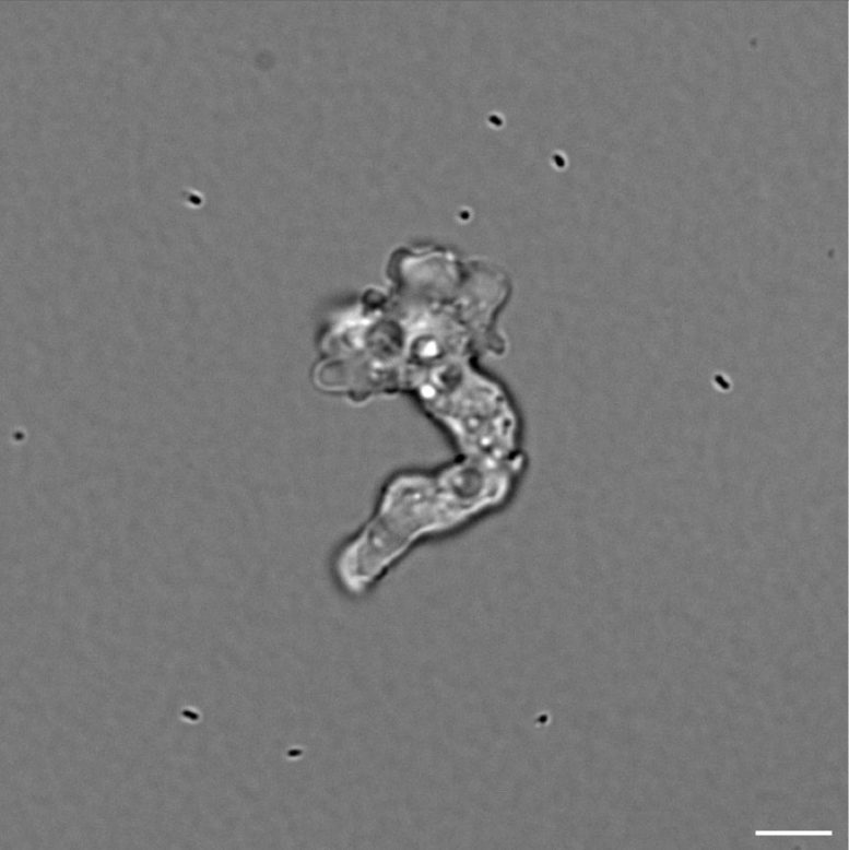 Amoeba at 55C