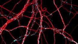 Amyloid Beta Binds to Hippocampus Nerve Cells