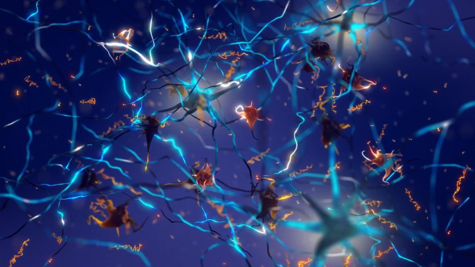 Amyloids May Not Cause Alzheimer’s Quantum Effect in the Brain