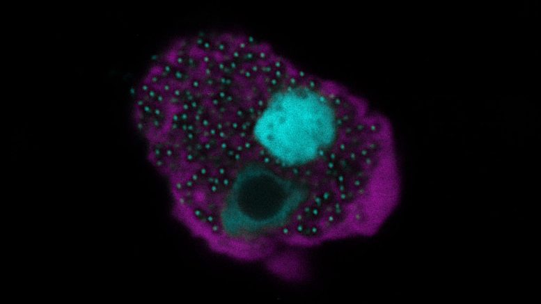Uma célula de ameba infectada com o vírus Naegleria