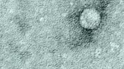 An image of hepatitis C