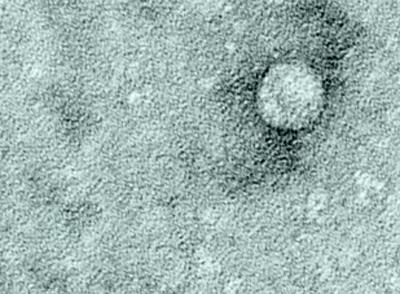 An image of hepatitis C 