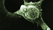 An invasive cancer cell moves with its leading edge