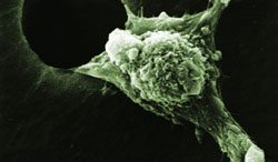 An invasive cancer cell moves with its leading edge