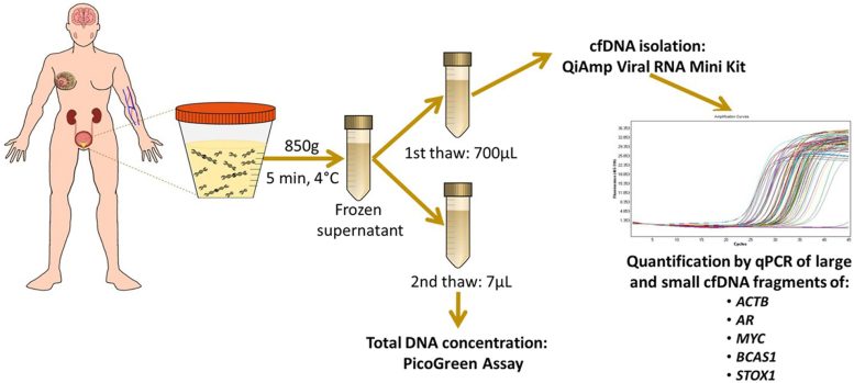 Analysis of the Fragmentation and Integrity of Urine Cell Free DNA as a Diagnostic and Staging Biomarker for Bladder Cancer