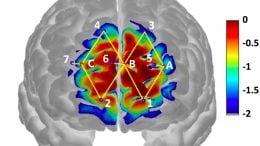 Analyzing Brain Activity to Diagnose and Treat Pain