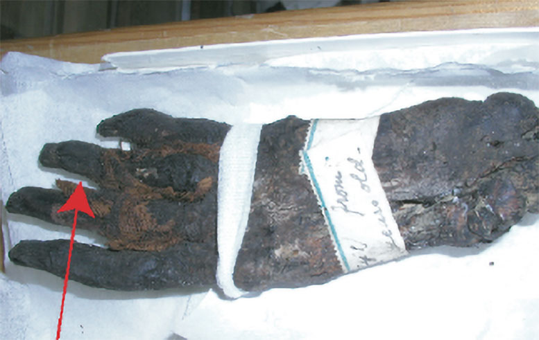 Ancient Egyptian Mummy Samples Taken From the Finger of the Mummified Female Hand