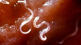 Ancylostoma Caninum Hookworms