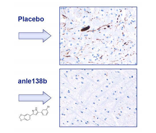 Anle138b Slows Down the Onset and Progression of Parkinsons Disease