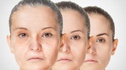 Anti-Aging Rejuvenation Concept