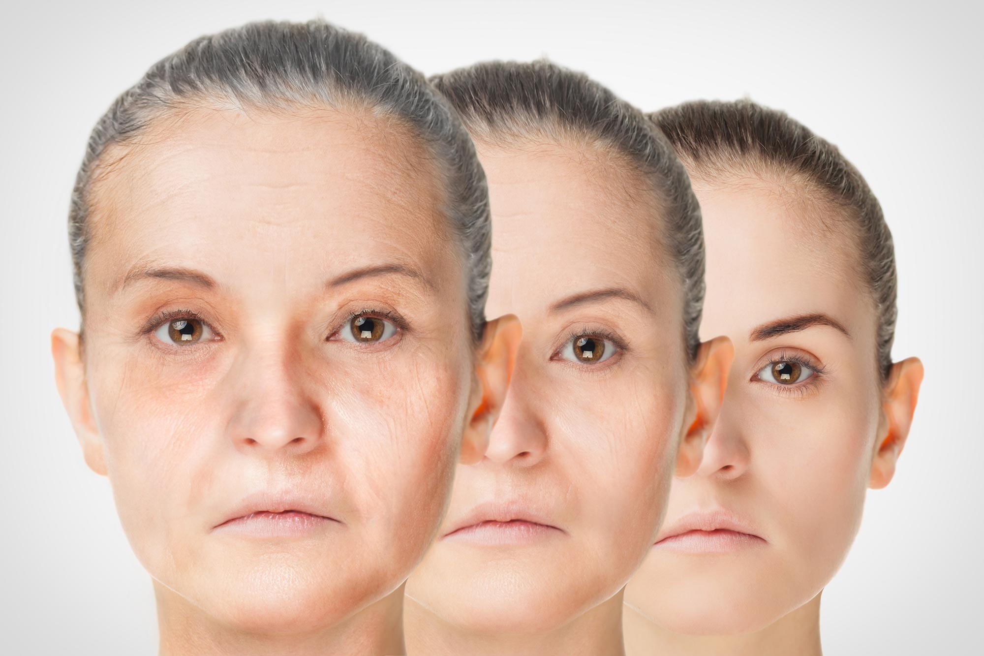 Old Skins Cells Reprogrammed To Regain Youthful Function