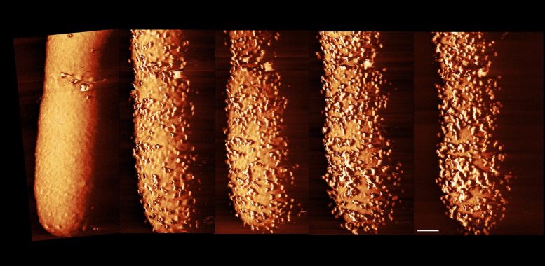 Incredible Images Show Antibiotics Shattering Deadly Bacteria’s Armor