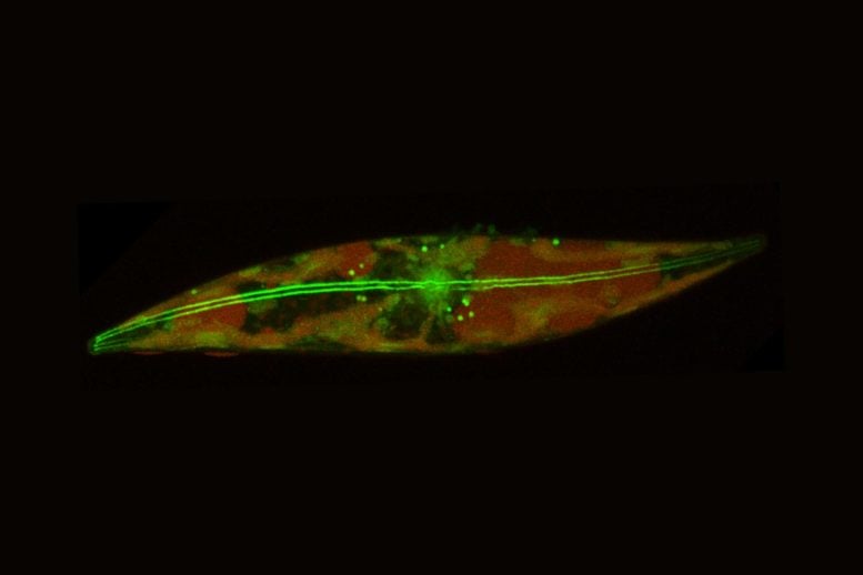 Arctic Diatom Actin Filaments
