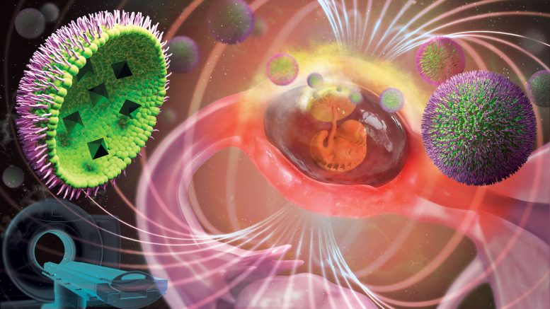 Artistic Illustration of Ectopic Pregnancy Nanomedicine