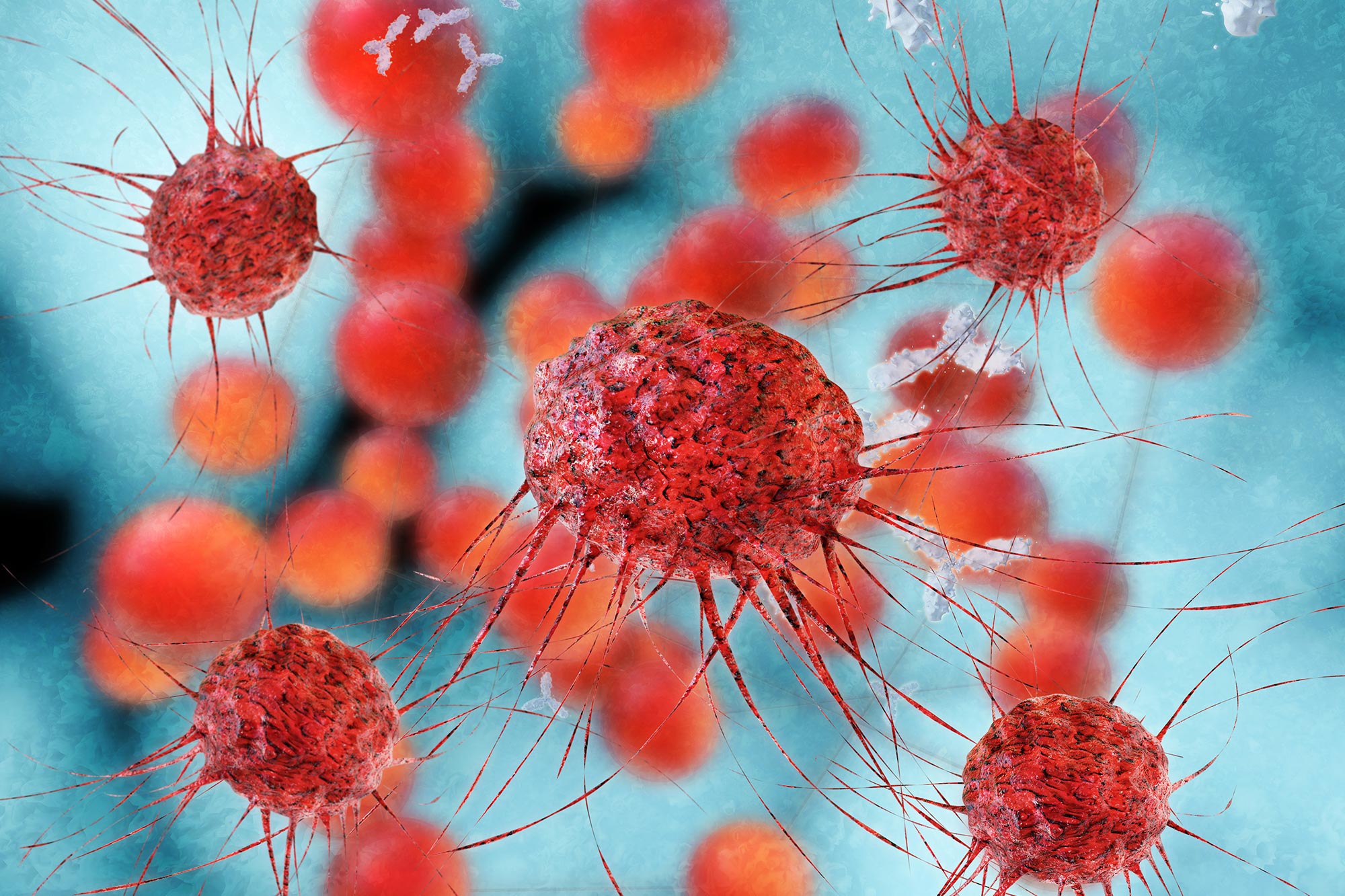 Что такое раковые клетки