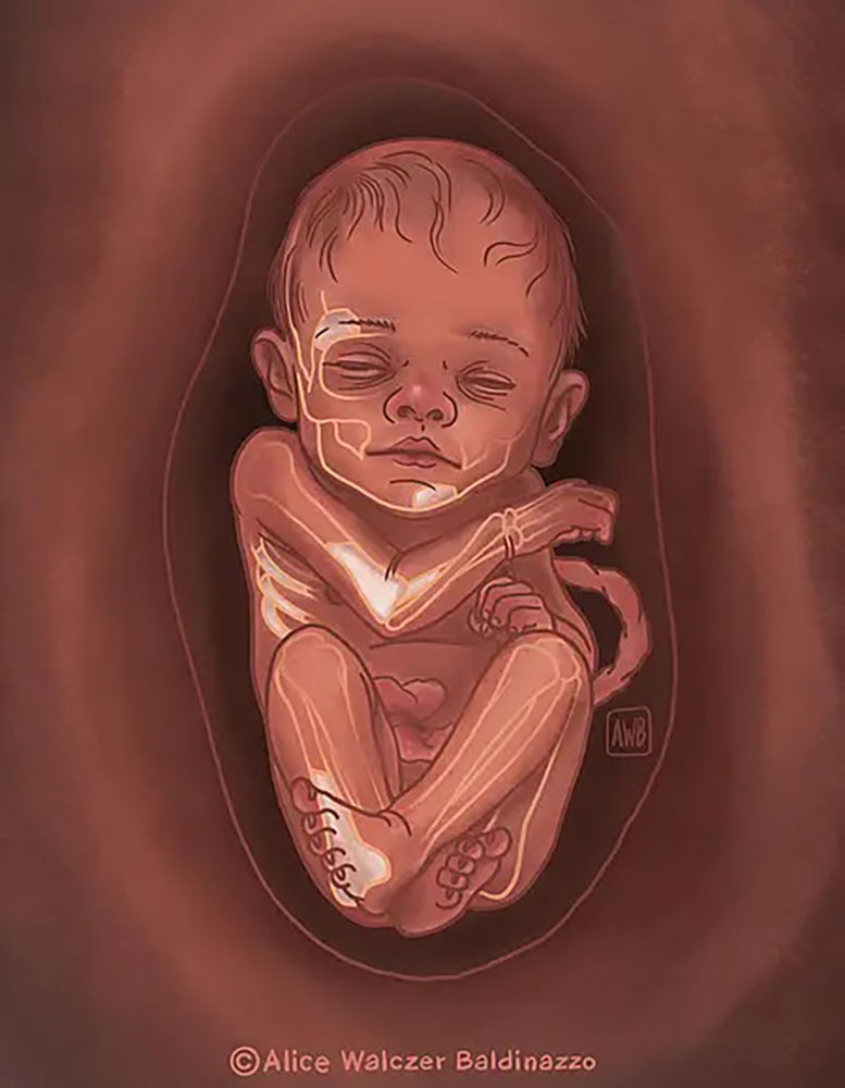 Artist’s Reconstruction of the Neanderthal Foetus From Sesselfelsgrotte in Germany