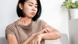 Asian Woman Rash Itch Hives