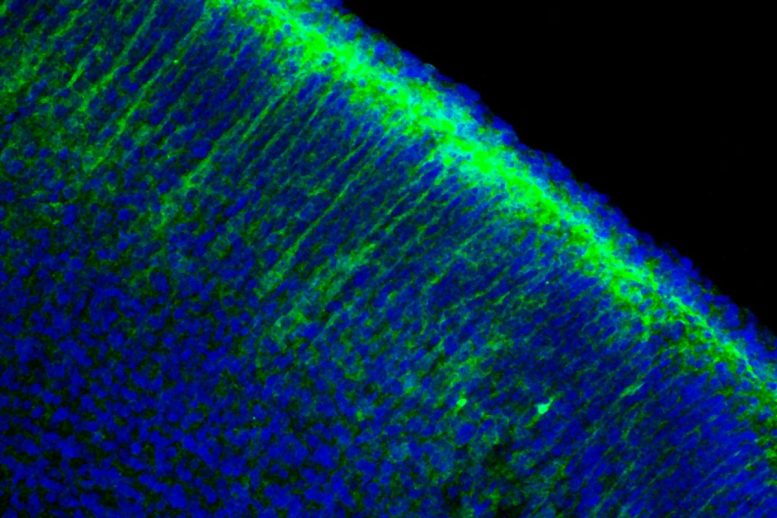 Asparagine Synthetase in Angelman Syndrome Neurons