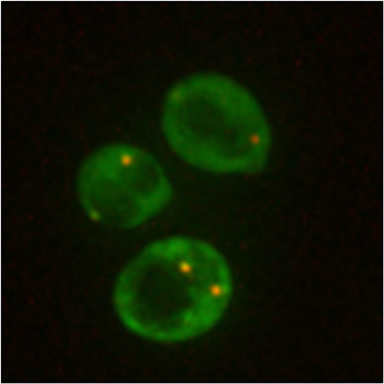 Assembly of Cytoplasmic RNP Condensates in Yeast Cells