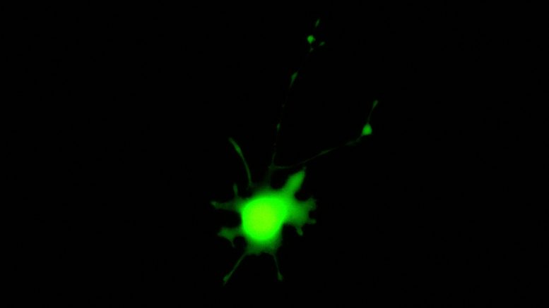 Astrocyte Infected With Modified SARS-CoV-2