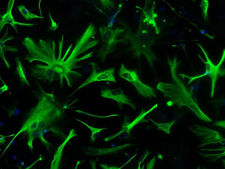 Astrocytes Derived From hiPSCs of a Patient With Alzheimer's Disease