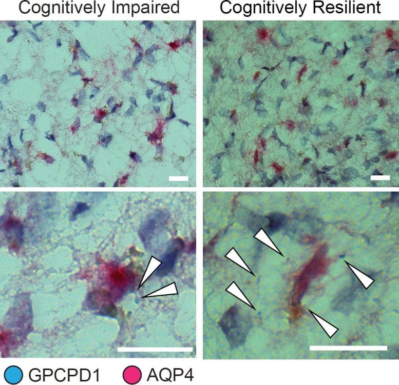 Astrocytes Resilience Alzheimer’s Disease