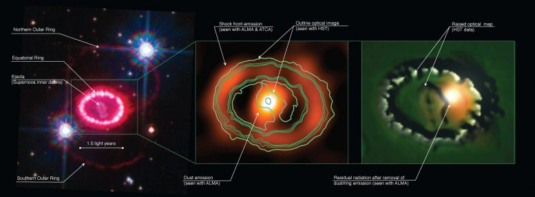 Astronomers Dissect the Aftermath of Supernova 1987A