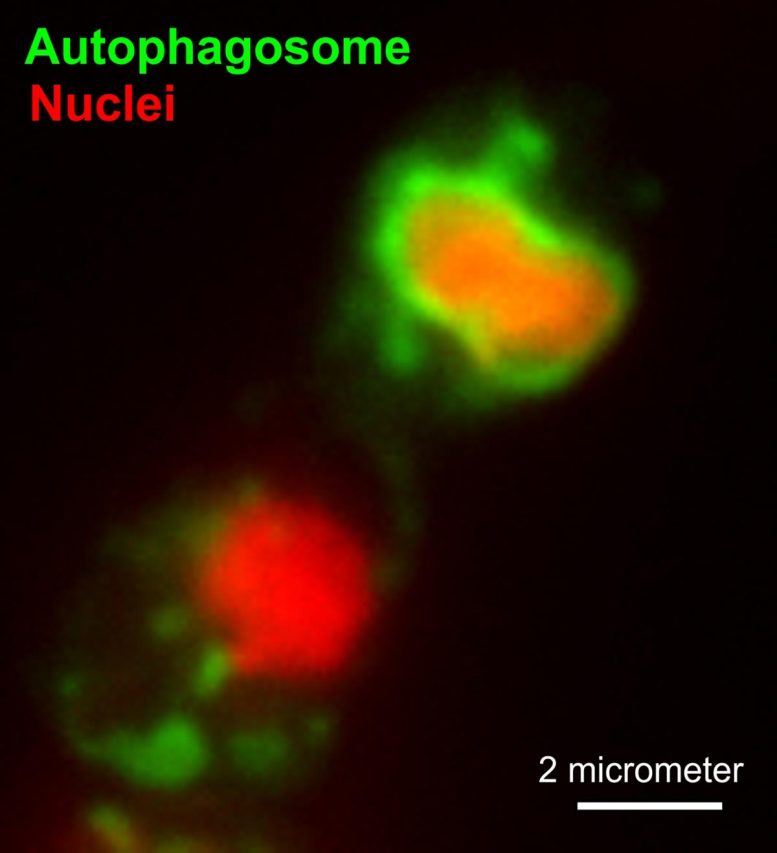 Autophagosome “Eating” Nucleus
