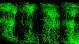 Axon Branching Images