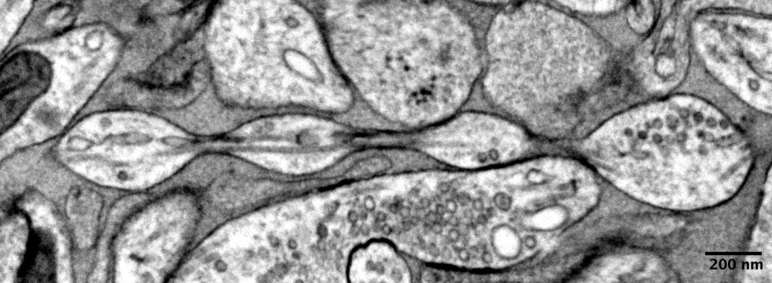 Nano-Pearls: The Stunning Discovery That Challenges How We See the Brain