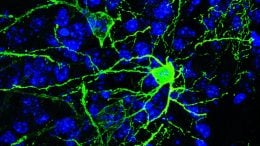 BSNT Neurons